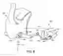Fig. 08 - Bio-mechanical prosthetic thumb