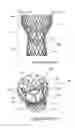 Fig. 02 - STENT ASSEMBLIES INCLUDING PASSAGES TO PROVIDE BLOOD FLOW TO CORONARY ARTERIES AND METHODS OF DELIVERING AND DEPLOYING SUCH STENT ASSEMBLIES