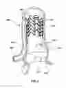 Fig. 09 - STENT ASSEMBLIES INCLUDING PASSAGES TO PROVIDE BLOOD FLOW TO CORONARY ARTERIES AND METHODS OF DELIVERING AND DEPLOYING SUCH STENT ASSEMBLIES