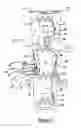 Fig. 02 - Vascular endograft