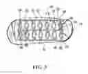 Fig. 04 - Helical hybrid stent