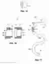 Fig. 09 - System and method for conditioning an endoprosthesis