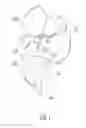 Fig. 02 - Intragastric device for treating obesity