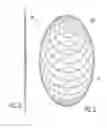Fig. 07 - Intragastric device for treating obesity