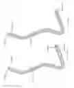 Fig. 49 - Intragastric device for treating obesity
