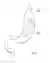 Fig. 85 - Intragastric device for treating obesity