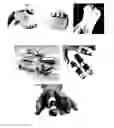 Fig. 01 - SYSTEMS FOR CORRECTING DIGITAL DEFORMITIES