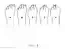 Fig. 07 - SYSTEMS FOR CORRECTING DIGITAL DEFORMITIES