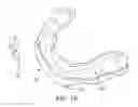 Fig. 06 - Oral appliance