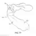 Fig. 07 - Oral appliance