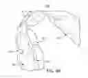 Fig. 28 - Oral appliance