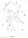 Fig. 10 - FREE FLOATING PATIENT INTERFACE FOR LASER SURGERY SYSTEM