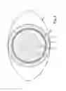 Fig. 04 - Treatment apparatus for correcting a refractive error of an eye