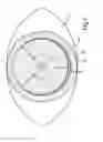 Fig. 06 - Treatment apparatus for correcting a refractive error of an eye