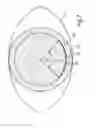 Fig. 08 - Treatment apparatus for correcting a refractive error of an eye