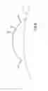 Fig. 09 - Treatment apparatus for correcting a refractive error of an eye