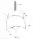 Fig. 04 - Three-dimensional negative pressure stimulator module capable of performing customized composite stimulation for improvement of skin functions