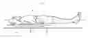 Fig. 01 - Physical therapeutic assemblies and methods for providing physical therapy