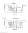 Fig. 08 - System and method for distinguishing manual from automated CPR