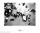 Fig. 04 - PHARMACEUTICALLY ACCEPTABLE SALTS OF beta-GUANIDINOPROPIONIC ACID WITH IMPROVED PROPERTIES AND USES THEREOF