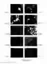 Fig. 30 - PHARMACEUTICALLY ACCEPTABLE SALTS OF beta-GUANIDINOPROPIONIC ACID WITH IMPROVED PROPERTIES AND USES THEREOF