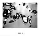 Fig. 04 - Pharmaceutically acceptable salts of B-guanidinopropionic acid with improved properties and uses thereof