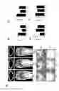 Fig. 09 - PHARMACEUTICAL COMPOSITIONS FOR INHIBITING THE OSTEOCLAST DIFFERENTIATION COMPRISING EUPATILIN
