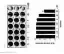 Fig. 10 - PHARMACEUTICAL COMPOSITIONS FOR INHIBITING THE OSTEOCLAST DIFFERENTIATION COMPRISING EUPATILIN