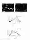 Fig. 02 - Risperidone sustained release microsphere composition