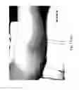 Fig. 22 - MEDICAMENT FOR TREATING PERIPHERAL NEUROPATHIES