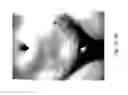 Fig. 28 - MEDICAMENT FOR TREATING PERIPHERAL NEUROPATHIES