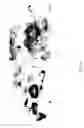 Fig. 37 - MEDICAMENT FOR TREATING PERIPHERAL NEUROPATHIES