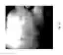 Fig. 43 - MEDICAMENT FOR TREATING PERIPHERAL NEUROPATHIES