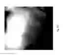 Fig. 45 - MEDICAMENT FOR TREATING PERIPHERAL NEUROPATHIES