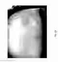 Fig. 46 - MEDICAMENT FOR TREATING PERIPHERAL NEUROPATHIES