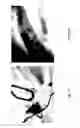 Fig. 47 - MEDICAMENT FOR TREATING PERIPHERAL NEUROPATHIES