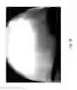 Fig. 48 - MEDICAMENT FOR TREATING PERIPHERAL NEUROPATHIES
