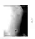 Fig. 49 - MEDICAMENT FOR TREATING PERIPHERAL NEUROPATHIES