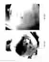 Fig. 52 - MEDICAMENT FOR TREATING PERIPHERAL NEUROPATHIES