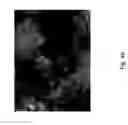 Fig. 68 - MEDICAMENT FOR TREATING PERIPHERAL NEUROPATHIES