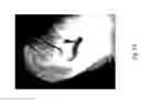 Fig. 75 - MEDICAMENT FOR TREATING PERIPHERAL NEUROPATHIES