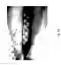 Fig. 80 - MEDICAMENT FOR TREATING PERIPHERAL NEUROPATHIES