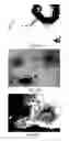 Fig. 82 - MEDICAMENT FOR TREATING PERIPHERAL NEUROPATHIES