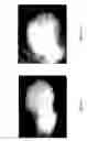 Fig. 83 - MEDICAMENT FOR TREATING PERIPHERAL NEUROPATHIES