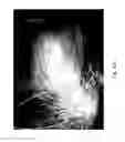 Fig. 84 - MEDICAMENT FOR TREATING PERIPHERAL NEUROPATHIES