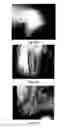 Fig. 86 - MEDICAMENT FOR TREATING PERIPHERAL NEUROPATHIES