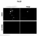 Fig. 13 - Compositions Useful for Treating Herpes Simplex Keratitis, and Methods Using Same