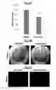 Fig. 17 - Compositions Useful for Treating Herpes Simplex Keratitis, and Methods Using Same