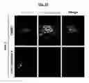 Fig. 30 - Compositions Useful for Treating Herpes Simplex Keratitis, and Methods Using Same