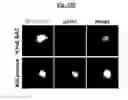 Fig. 38 - Compositions Useful for Treating Herpes Simplex Keratitis, and Methods Using Same